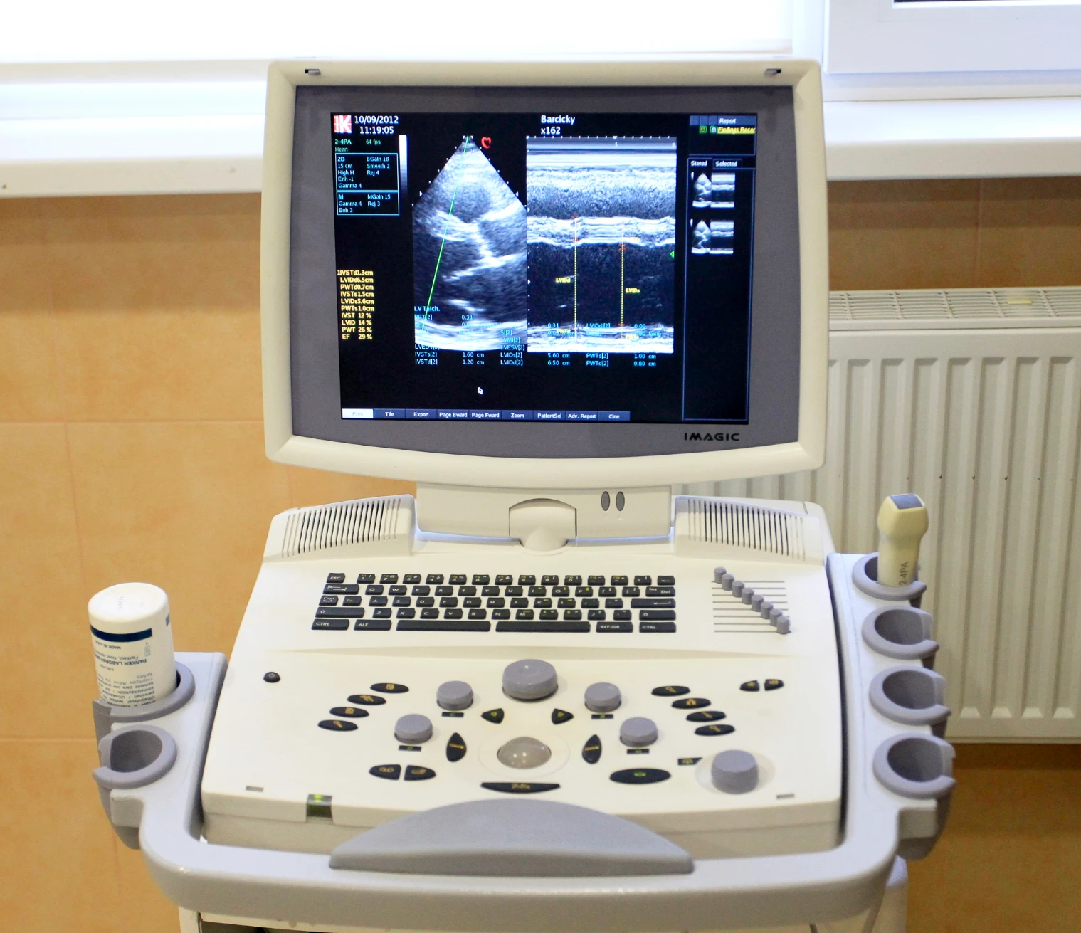 Advancements in Emergency Medical Equipment - portable ultrasound machine