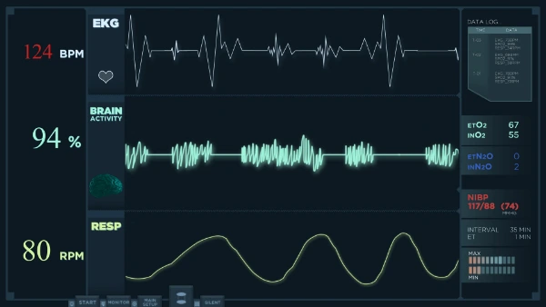 Vital signs monitor displaying a rapid, irregular ECG pattern with a heart rate of 124 BPM, elevated brain activity, and steady respiration. These fluctuations may indicate acute cardiac stress or a transition into a shockable rhythm requiring immediate ACLS intervention.