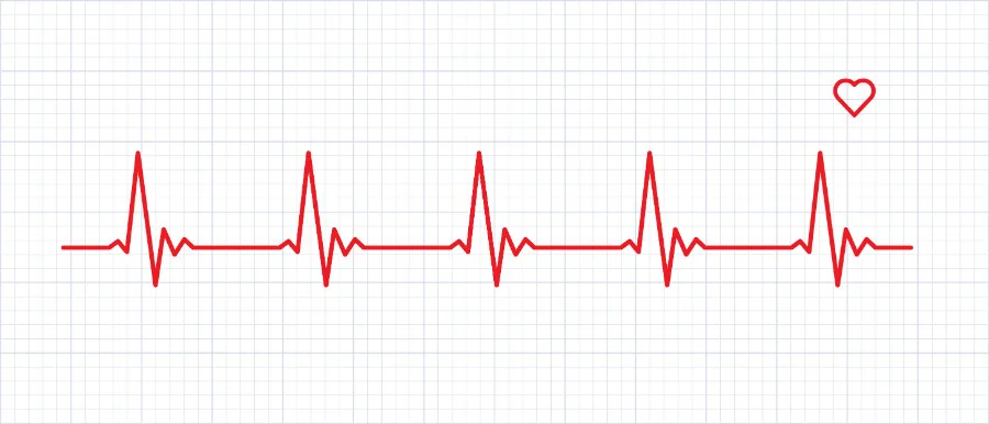 Systematic Approach to ECG Interpretation